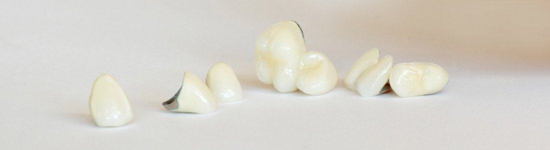 Dental Crowns