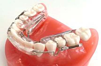 Inman aligner