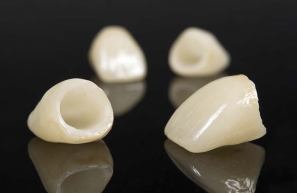 Full ceramic cosmetic crowns